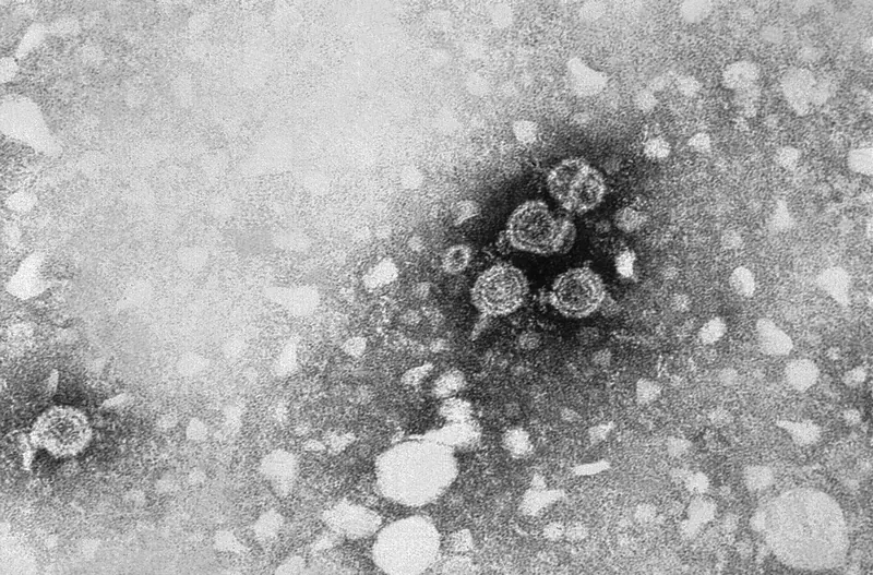 Brelovitug : hépatite D, un anticorps réussit sa phase 3