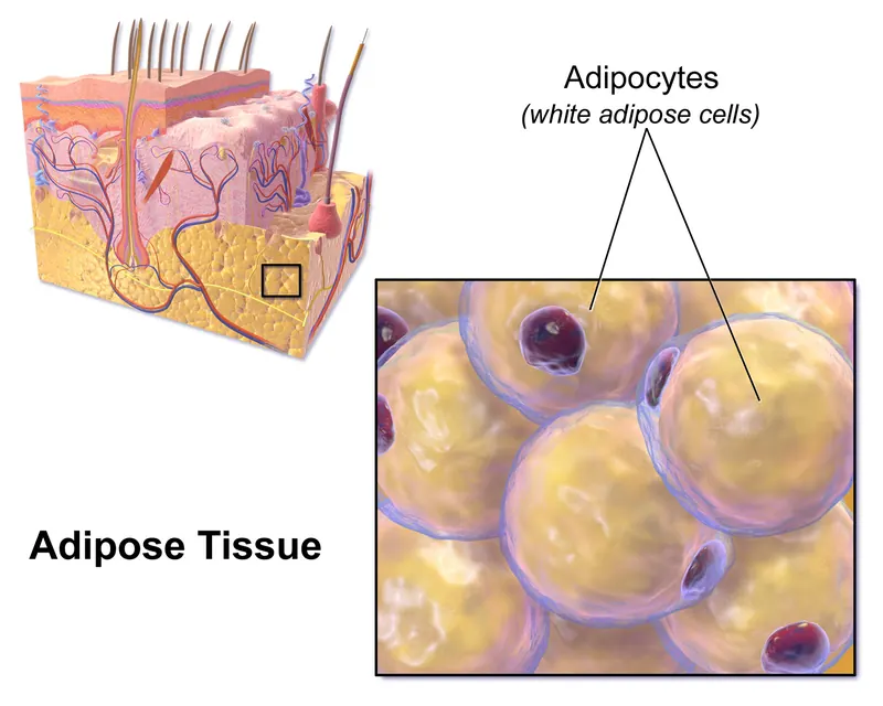 CBL-514 : une injection qui détruit les cellules graisseuses testée